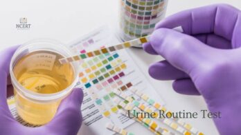 Urine Routine Test : Cost and normal values - infrexa