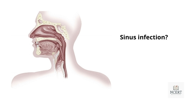 Sinus affected area