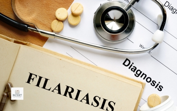Filariasis Diagnosis