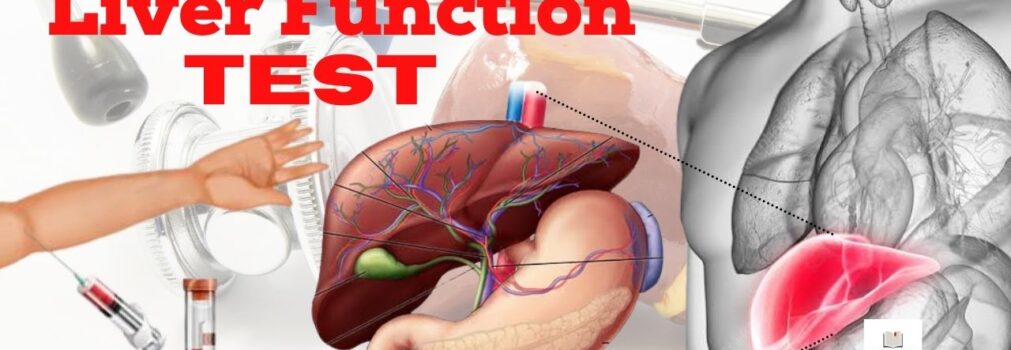 Liver Function Test (LFT)