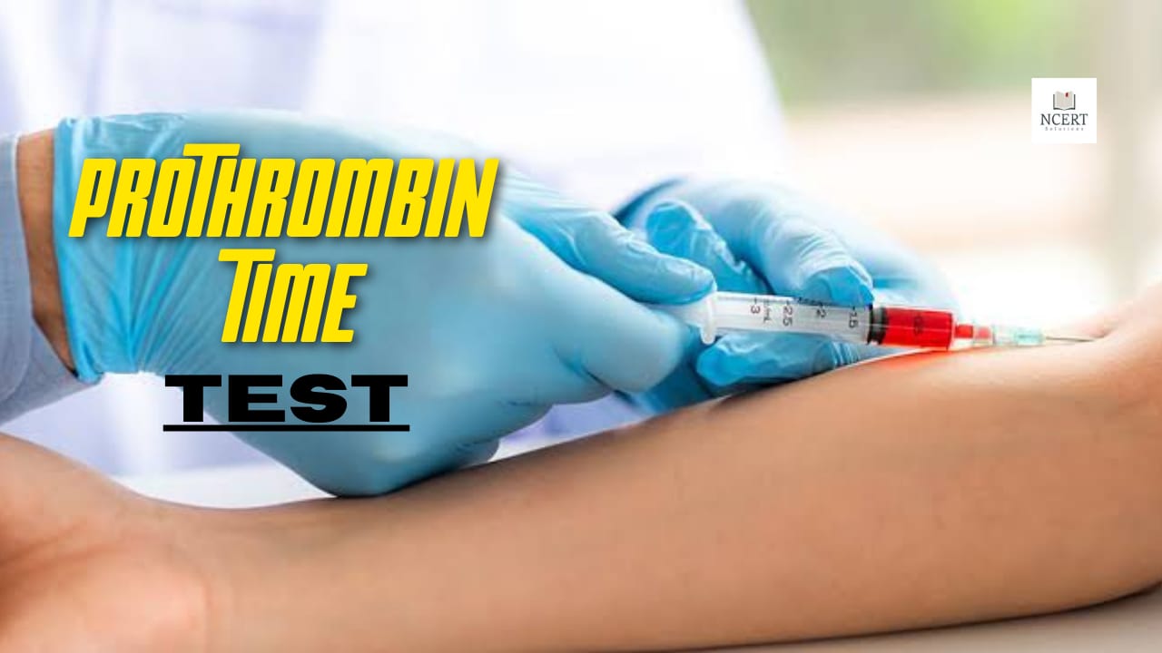 Prothrombin Time Test