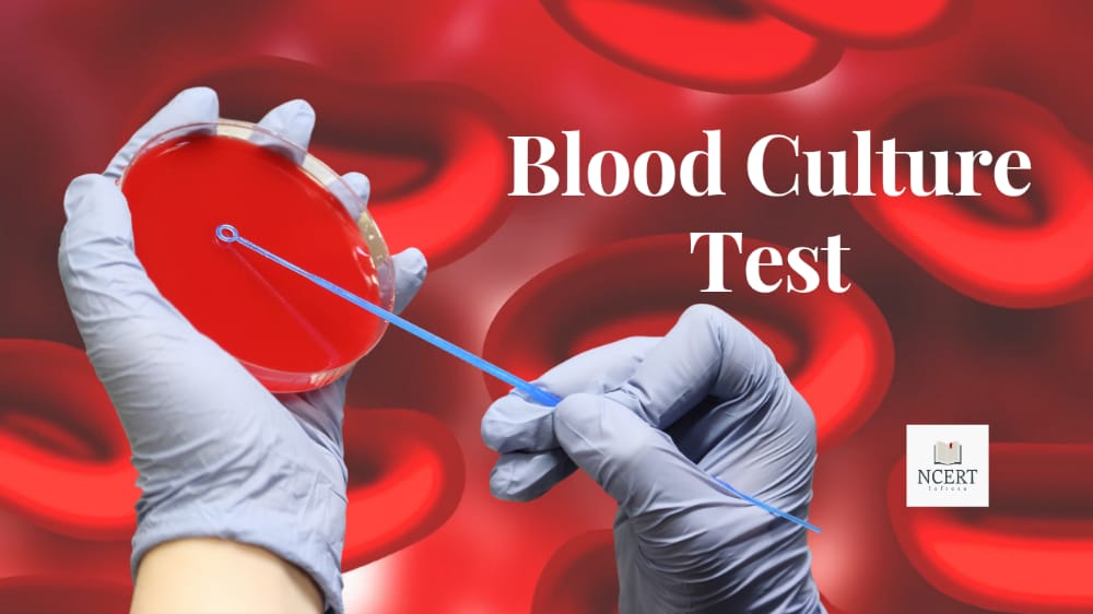 Blood Culture Test