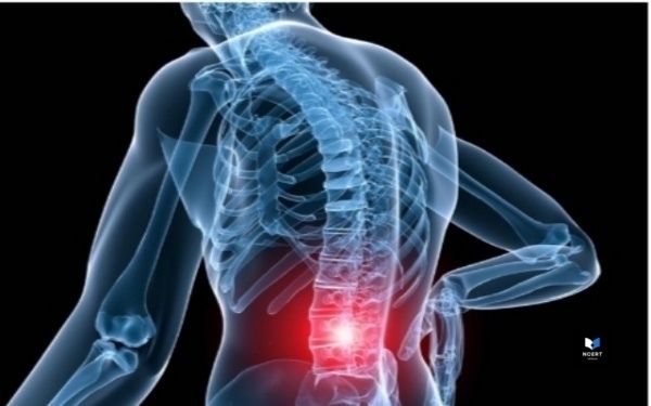 पुरुषों में कमर दर्द के कारण, लक्षण और उपचार | Back pain in men in Hindi